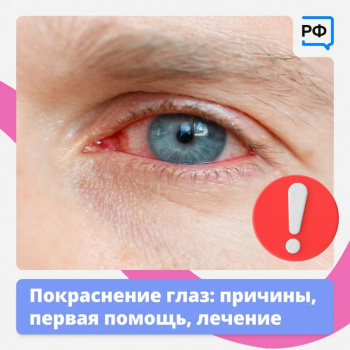 Покраснение глаз Причины, первая помощь, лечение